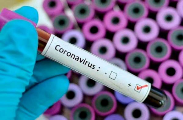 Захворюванні коронавірусом в Херсонській області