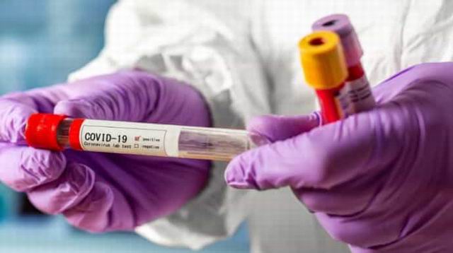 коронавірусна хвороба  в Херсонській області на 10 січня 2022 року