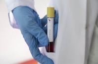 Інформація про коронавірус на Херсонщині станом на 28 травня 2021 року
